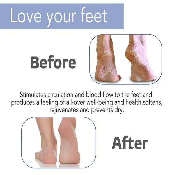 🏆Flash Sale⚡ 50K+ SOLD! Almost Gone-💥Silicone Shower Foot Scrubber Mat，Best gifts💥